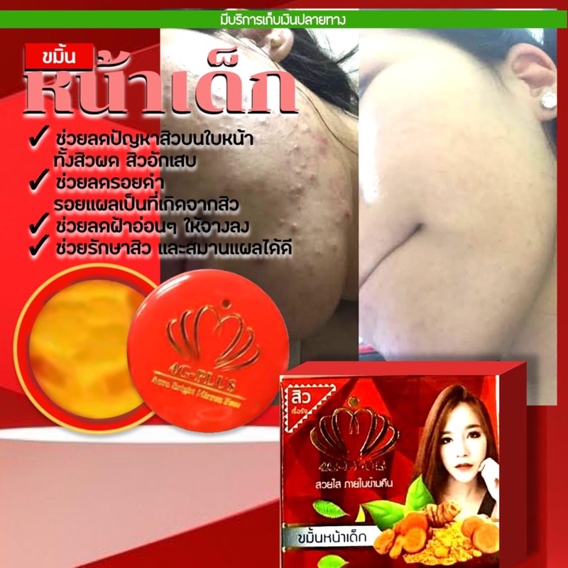 ครีมขมิ้นหน้าใส4GPLUS