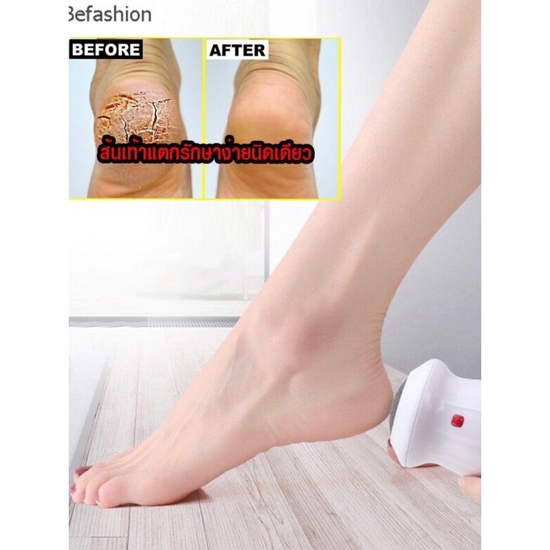 Lady Shop 💥เครื่องขัดส้นเท้าแตก💥ส่งไว!!