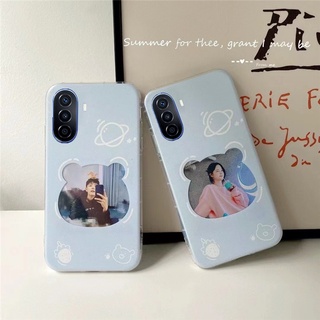 เคสโทรศัพท์ Ready Stock 2022 New Casing Huawei Nova Y70 / Honor X7 X9 4G Handphone Case Photo Frame Blue Bear Pattern TPU Soft Cover Shockproof Protective Case เคส