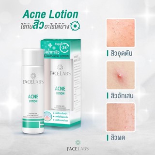 FACELABS Acne Lotion เฟซแลบซ์ แป้งน้ำลดสิว