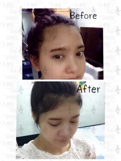 📣Witch Hair เซรั่มปลูกผม คิ้ว หนวด ขวดแรกเห็นผล💯% ขนาด 60ml.