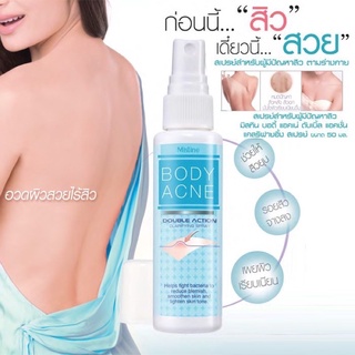 Mistine Body Acne Double Action Clarifying Spray 50 ml. มิสทิน บอดี้ แอคเน่ สเปรย์ฉีดสิวที่หลัง ป้องกันการเกิดสิวที่หลัง