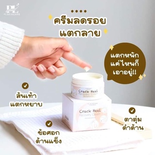 ครีมทาส้นเท้า ครีมลดรอยแตกลาย : Crack Heel Recovery Cream