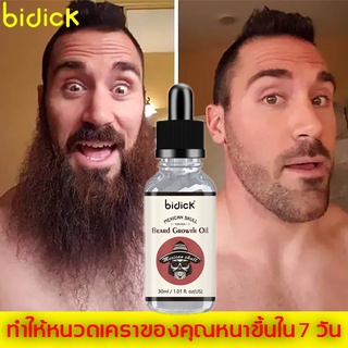 Bidick ปลูกหนวด น้ำยาปลูกหนวด30ml เร่งหนวดยาว ปลูกเครา ปลูกคิ้ว ยาปลูกหนวด ยาปลูกเครา น้ำยาปลูกคิ้ว ปลูกคิ้วปลูกหนวด