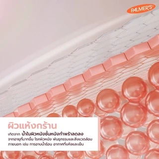 [แพ็ค 2] Palmer's Skin Therapy Oil 150 ml. ลดความแห้งกร้าน ป้องกันและลดรอยแตกลาย จางลงภายใน 2 เดือน ปาล์มเมอร์ ออยล์