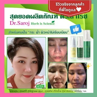 ดร.สาโรช ไฮ-โกล โลชั่นรักษาฝ้าสูตรเข้มข้น สำหรับผิวมัน (Dr.Saroj Hi-Glow)