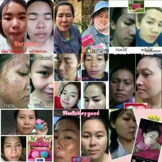 เววิกา wewika ขายส่ง🌸 ครีมเวรี่กูด🎁พร้อมส่ง🎁ไนท์ครีม