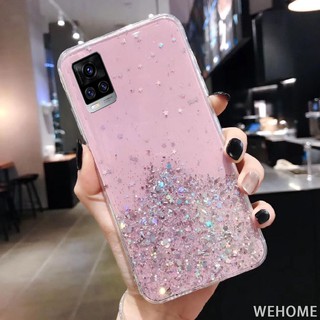 ( Cod ) เคสโทรศัพท์มือถือลาย Starry Shiny สําหรับ Vivo Y31 2021