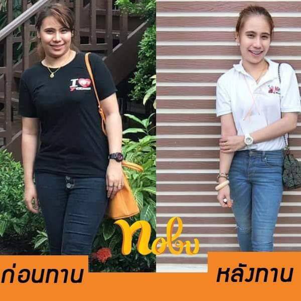 🔥พร้อมส่ง+มีโค๊ดลด🔥โนบุพลัส อาหารเสริมควบคุมน้ำหนัก ช่วยควบคุมความหิว อิ่มนาน เบริ์นไวพุงยุบ กระชับสัดส่วนไม่โยโย่ - รูปที่ 4
