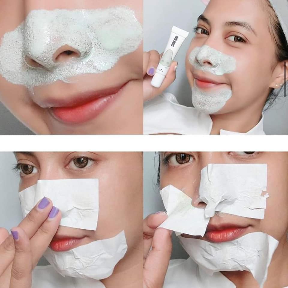 Nakiz Lively Nose ลอกสิวเสี้ยน กำจัดสิวเสี้ยน ครีมลอกสิวเสี้ยน สิวหัวดำ