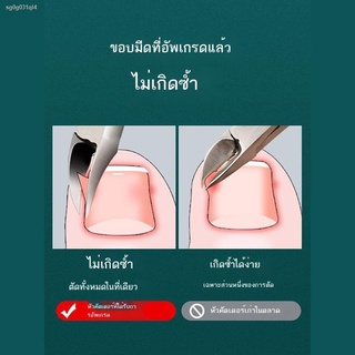 อุปกรณ์ตัดเล็บขบ ที่ตัดเล็บขบแบบไม่เจ็บ ที่งัดเล็บขบ ที่ตัดเล็บขบ ที่แซะเล็บขบ กันไกรตัดเล็บ Paronychia กรรไกรตัดเล็บพิเ