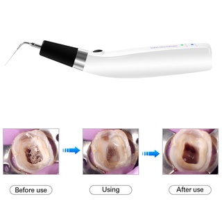 Azdent Dental Endo Ultra Activator Endo Ultra Activator หูฟังทันตกรรม