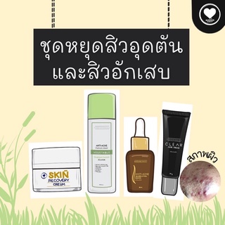 Set ลดสิวอุดตันและสิวอักเสบ