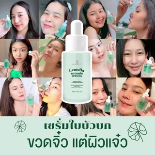 ของแท้ ส่งฟรี/มีของแถม✅ Centella miracle serum ANACOLLY เซรั่มใบบัวบก เซรั่มอานาคอลลี่ เหมาะสำหรับผิวแพ้ง่าย