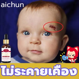 aichun เซรั่มลบรอยแผลเป็น（ครีมลบรอยแผลเป็น，ครีมลบแผลเป็น，เซรั่มลบรอยแผลเป็น，ยาลบลอยแผลเป็น，เจลลบรอยแผลเป็น，รอยสิวแผลเป็น