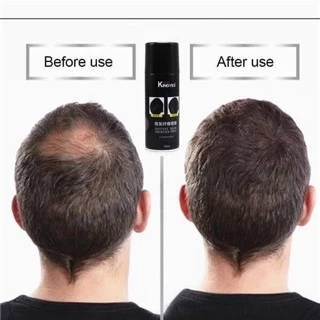 kingyes hair spray สเปรย์ผมไฟเบอร์ ปิดผมขาว ปิดผมบาง แก้ปัญหาหัวล้าน