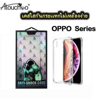 KingKong เคสใส OPPO รุ่นใหม่ล่าสุด เคสกันกระแทก oppo Reno7 5g A76 realme 9i realme c35