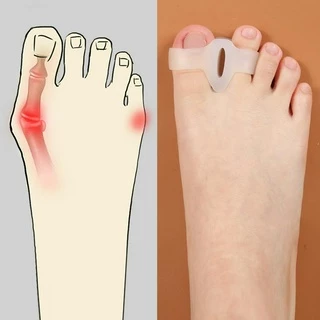 2 ชิ้นซิลิโคนเจลนิ้วเท้าแยกสําหรับ Hallux Valgus Therapy, ป้องกันอาการปวด, ป้องกันตาปลา, 2 แหวนเจลค้อน Toe Pad สําหรับผู้หญิง, ผู้ชาย & เด็ก