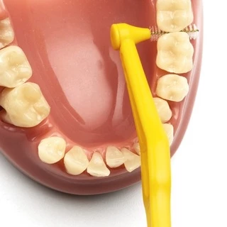 [ราคาต่อชิ้น ] แปรงซอกฟัน TEPE ANGLE พร้อมปลอก (Made in Sweden) จำนวน 1 ชิ้น