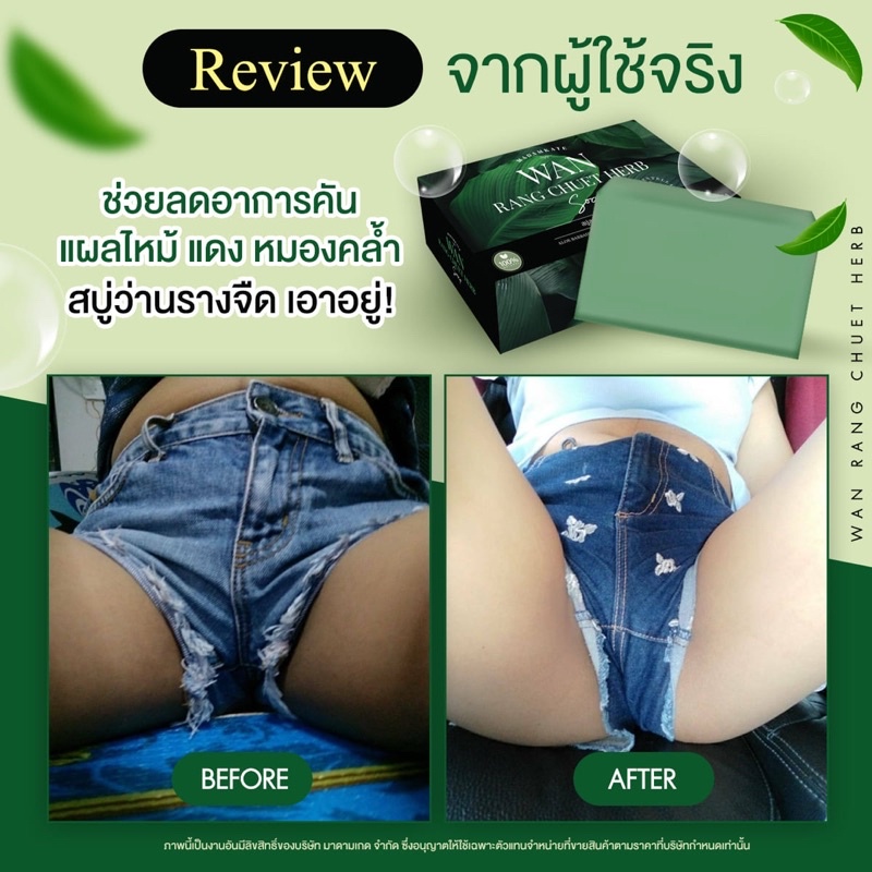 ส่งฟรี สบู่สมุนไพรว่านรางจืด สารสกัดว่านหางจระเข้ แก้สะเก็ดเงิน อาการคันตามผิวหนัง สบู่รักษาโรคผิวหนัง กลาก เกลื้อน ราคา ถูกที่สุด ดีลบีเคเค แกลเลอรีภาพที่ 8