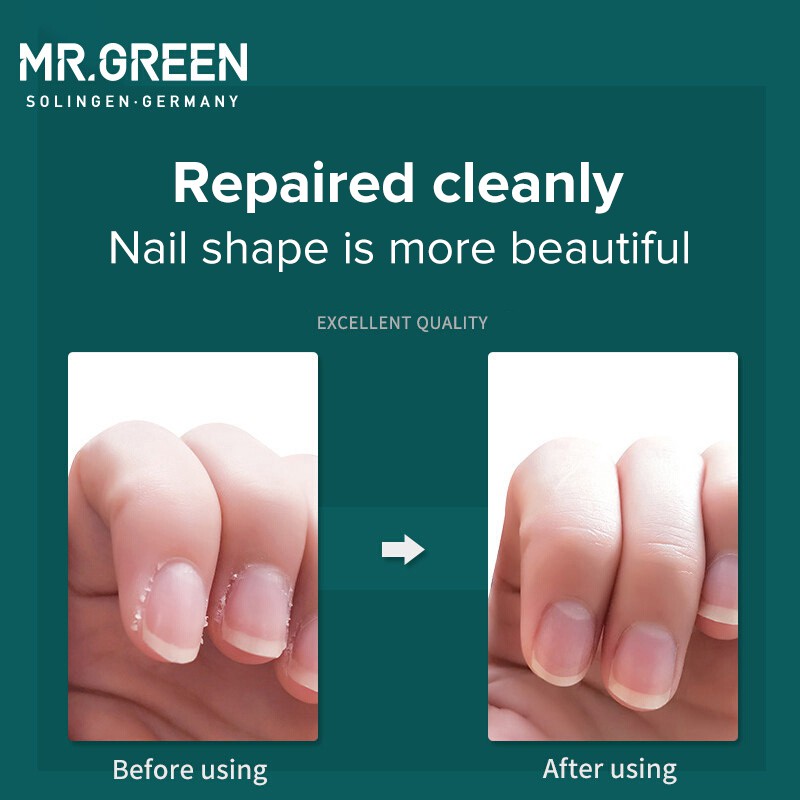 Mr.green กรรไกรตัดหนังกําพร้า หนังกําพร้า สเตนเลส เครื่องมือกรรไกรตัดหนังกําพร้า เล็บเท้า ราคา ถูกที่สุด ดีลบีเคเค แกลเลอรีภาพที่ 3