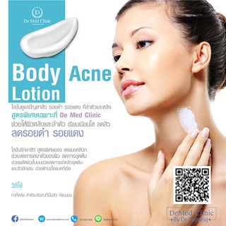 Body Acne Lotion โลชั่นดูแลปัญหาสิว รอยดำ รอยแดง ที่ลำตัวและหลังพิเศษ 350 บาท จาก ปกติ 500 บาท DeMed Clinic