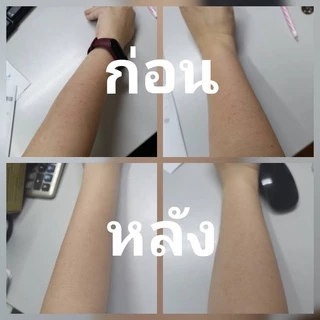 หัวไชเท้าออร์แกนิคสกัดเย็น100% เช็ดฝ้าก่อนทาครีม ผสมครีม สลายฝ้ากระ