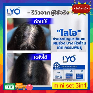 ❗️เซต3ชิ้น❗️ LYO Mini Set 3in1 ไลโอมินิ โทนิค 30ml. + ไลโอแชมพู 50ml. + ครีมนวด 50ml. แฮร์โทนิค Lyo by หนุ่มกรรชัย ไลโอม