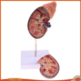 Lifesize 1:1 Human Anatomical Kidney Adrenal Gland Model w/Base Lab Ornament