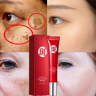 Melasma ครีมไวท์เทนนิ่ง กําจัดจุดด่างดํา รอยสิว กระ กระ จุดด่างดํา 20 กรัม CAHNSAI