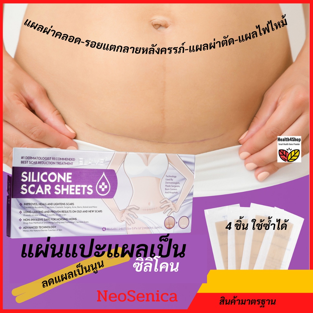 ✳️P26💦โค้ดลด-เกรดการแพทย์⚡ แผ่นแปะแผลเป็นซิลิโคน ลดแผลเป็นนูน 4 ชิ้น แผลผ่าคลอด รอยแตกลาย ตั้งครรภ์ 