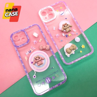 เคสออปโป้/Oppo A31 A5s A53 A93 A96เคสมือถือนิ่มใสกันกล้อง ซิลิโคน TPU ติดการ์ตูนกระต่ายนูนน่ารัก