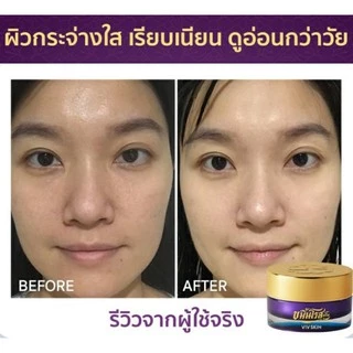 🔥โปรเซ็ต 4 ชิ้น‼️ ของแท้💯 VIV SKIN เซ็ตขมิ้น สูตร ORIGINAL (เซรั่ม + ครีม) วิฟสกิน ครีมจุ๋ย