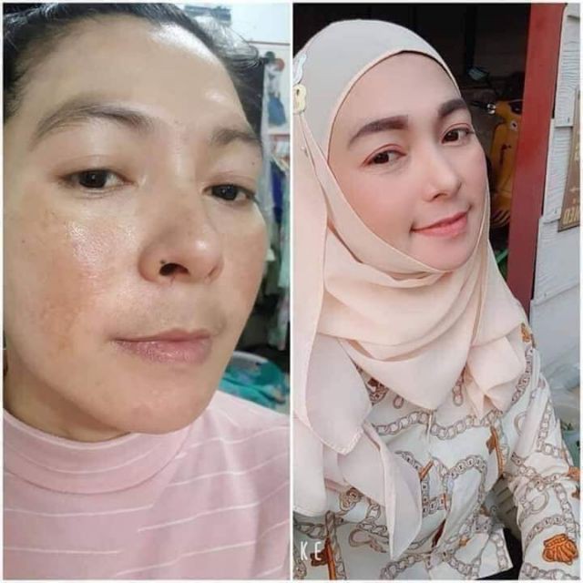 ครีมลิเดีย♥️ LYDIA ลิเดีย