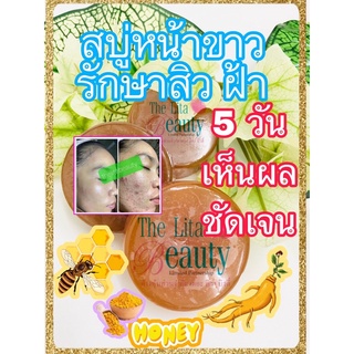 สบู่มาร์คหน้า #สบู่ลดสิว #สบู่หน้าขาว #สบู่ลดสิว#หน้ากระจ่างใส #ไร้สิว #ลดกระ #ลดฝ้า #สบู่หน้าขาว #แก้ฝ้า #ลดฝ้า