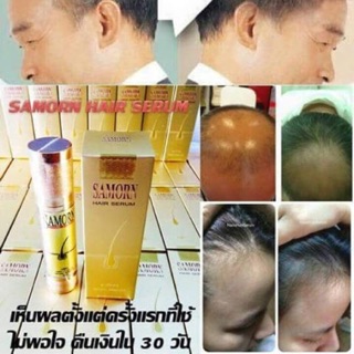 เซรั่มปลูกผมแซมออน SAMORN HAIR SERUM มีเก็บปลายทาง