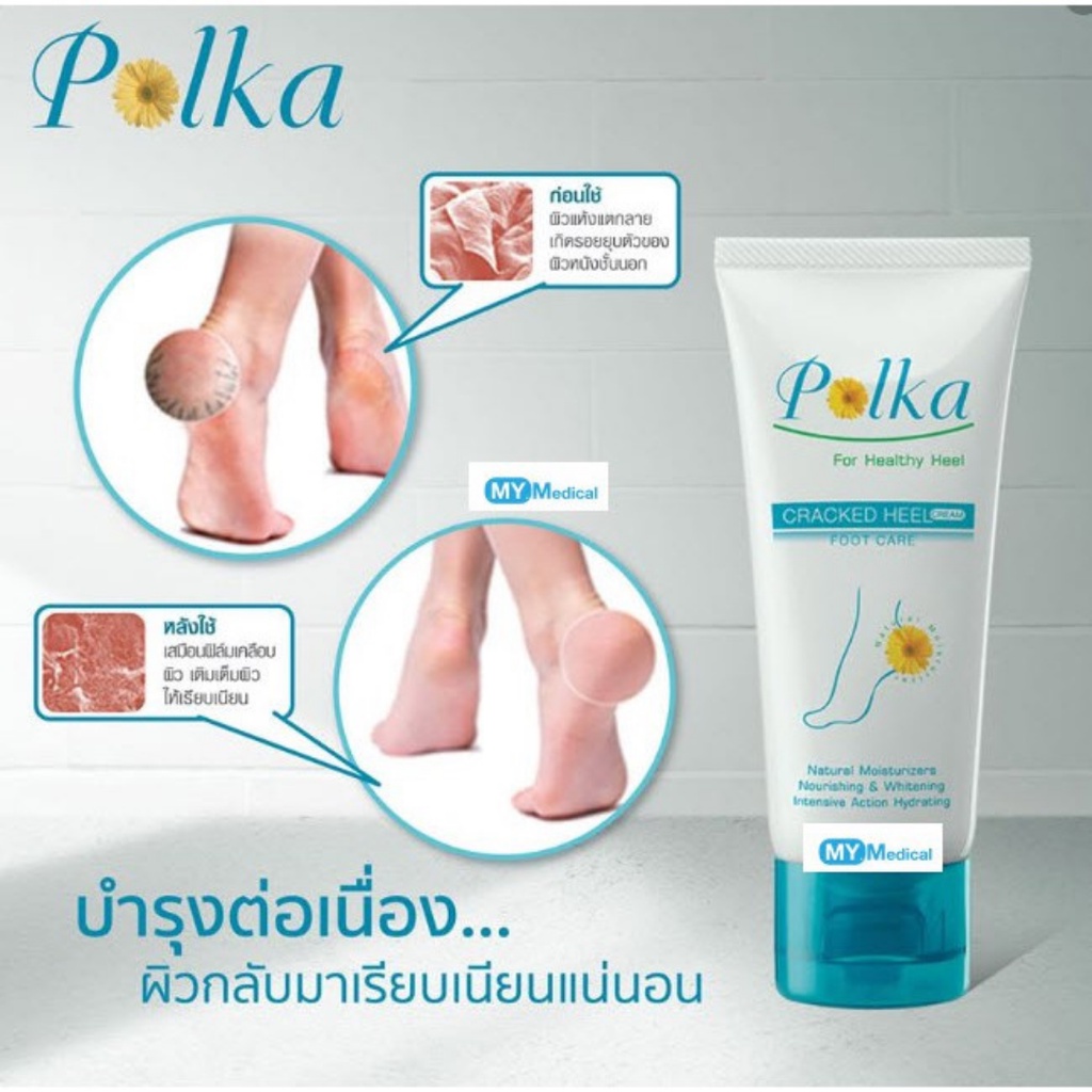 POLKA CREAM ครีมทาส้นเท้าแตก พอลก้า ครีมบำรุงและสมานรอยเท้าแตก - รูปที่ 4