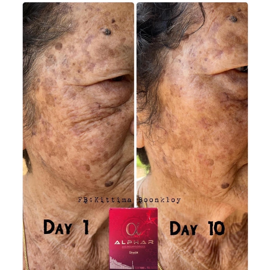 แท้ 100 Renatar AlphaR คอลลาเจนบำรุงผิวขาวใส ชะลอวัย กระ ฝ้า จางลง ...