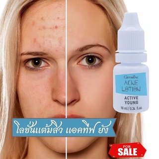👍กิฟฟารีนโลชั่นแต้มสิวแอคทีฟยัง😍หน้าใสไร้สิว👍กำจัดสิวเสี้ยนหน้าไม่พัง📌ขนาด10กรัม/1กระปุก/รหัส22101