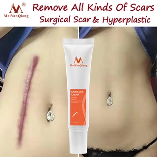 MeiYanQiong ยาทาแผลเป็น ครีมบำรุงหน้า ครีมแต้มสิว ซ่อมแซมผิวหนัง ต่อต้านรอยแตกลาย Skin Repair Scar Cream