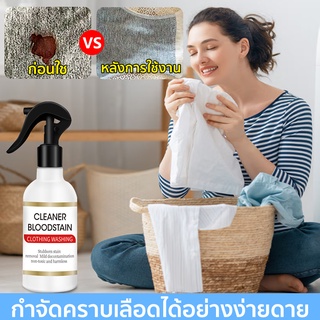 【สินค้าพร้อมส่ง】ขจัดคราบเลือด 250ml ช่วยขจัดคราบเลือดสิ่งสกปรกได้อย่างสะอาดหมดจด（คราบเลือด คราบประจำเดือน）(น้ายากำจัดคราบเลือดบนผ้า,น้ำยาขจัดคราบประจำเดือน,น้ำยาขจัดคราบเลือด,น้ำยาขจัดคราบเลือดผ้า,คราบเลือด,น้ำยาซักคราบเลือด,ล้างคราบประจำเดือน