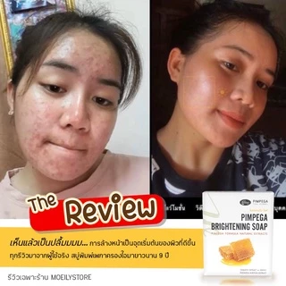 [ส่งไวมาก เปิดขนส่งเอง] สบู่พิมพ์เพกา ลดสิว หน้าสว่างใสอย่างเป็นธรรมชาติ