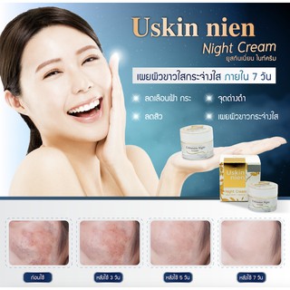 พร้อมส่ง Uskinnien night cream ครีมบำรุงผิวก่อนนอน    ลดอาการสิวอักเสบ  ครีม ยูสกินเนี่ยน ครีมกลางคืน ไนท์ครีม