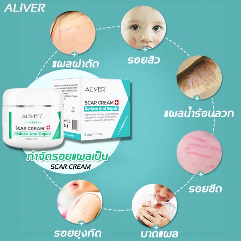 ALIVER Repair Scar Scar Cream Remove Stretch Mark Scald Caesarean Bump Surgery Scar ครีมลดรอยแผลเป็น