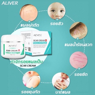 ALIVER Repair Scar Scar Cream Remove Stretch Mark Scald Caesarean Bump Surgery Scar ครีมลดรอยแผลเป็น สูตรสมุนไพร 50ml