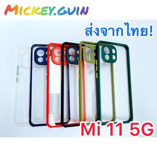 เคส Mi11 5G หลังใสอะคริลิค กันกล้อง ขอบกันลื่น กันกระแทก