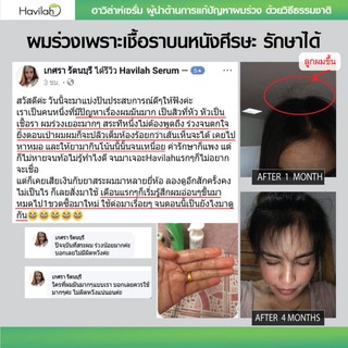 แฮร์โทนิคฮาวิล่าห์ Havilah เร่งผมยาว แก้คันศีรษะ ปริมาณ 100ml.จำนวน 3ขวด แถมสปา ปริมาณ 100ml.จำนวน 1 ขวด