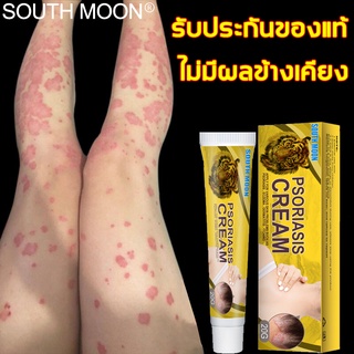 แท้ 100%🔥SOUTH MOON โรคผิวหนัง 1หลอด 20g ปลอดภัย อ่อนโยน ครีมติดเชื้อรา ครีมทาเชื้อรา ครีมทาโรคผิวหนัง โรคน้ำกัดเท้า