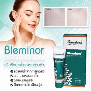 Bleminor Anti-Blemish Cream 30ml ครีมลดฝ้า กระ ฝ้าจากสิว ผลิตในอินเดีย