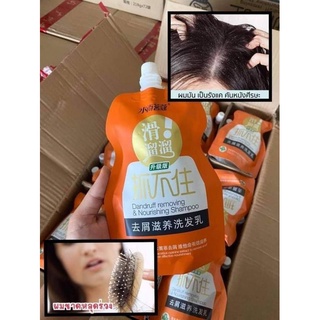 แชมพูนำเข้า Dandruff removing &amp; nourishing shampoo แชมพูขจัดรังแค 218 G ขจัดรังแค ให้ความชุ่มชื้นหนังศีรษะ ขนาด 218 มล.